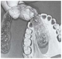 ماهي الطرق والاساليب المتبعه في تبييض الاسنان؟