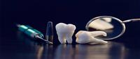 عملية زرع الأسنان... متى تكون الحل الأنسب للمريض؟