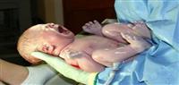 الولادة الطبيعية التالية للقيصرية