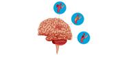  تمدد الأوعية الدموية في الدماغ 