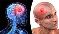  سرطان الرأس والرقبة أسبابه، أعراضه وطرق العلاج