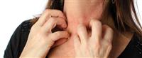 أسباب حساسية الجلد المفاجئة: أهم المحفزات من بيئتك