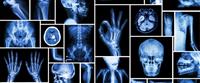 الأشعة السينية ما بين الفوائد والمخاطر 