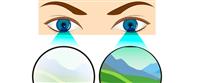العين الكسولة: الأسباب والأعراض وطرق العلاج