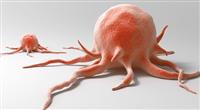 الأورام الخبيثة في الرئة- الأسباب, الأعراض والعلاج