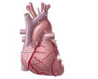 فلمبان: وفيات أمراض القلب تفوق أنواع الوفيات الأخر