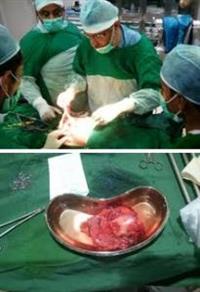 عملية جراحية نادرة 