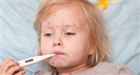 9 أمراض شائعة تصيب الأطفال