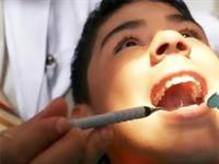 تخدير الأسنان يمنع نمو أضراس العقل