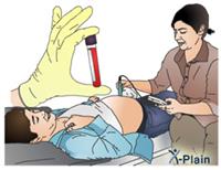 اختبارات قبل الولادة
