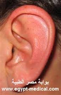 أمراض الأذن الخارجية