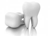 كيف يتم تعويض الأسنان المفقودة