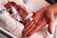 رعاية ما بعد الولادة أهم عوامل النمو الصحي للطفل الخديج