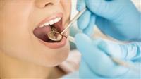 الحالات التي تحتاج إلى طربوش الأسنان