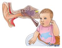 التهابُ الأذن الوسطى عند الأطفال
